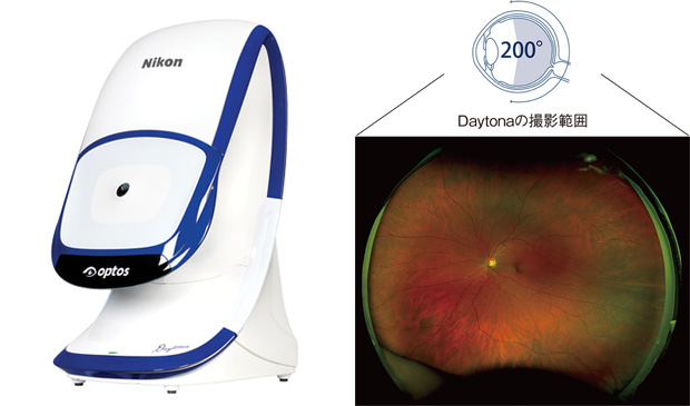 広角眼底撮影装置daytona
